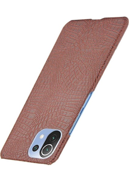 Xiaomi Mi 11 Lite Klasik Timsah Moda Kapak Için Şık Klasik Durumda (Yurt Dışından)