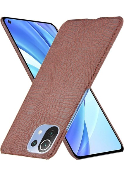 Xiaomi Mi 11 Lite Klasik Timsah Moda Kapak Için Şık Klasik Durumda (Yurt Dışından)