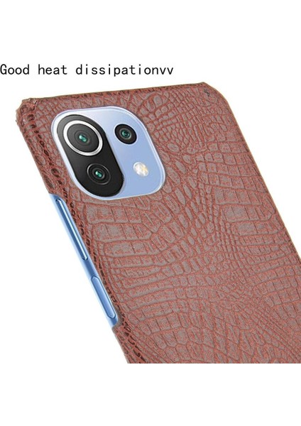 Xiaomi Mi 11 Lite Klasik Timsah Moda Kapak Için Şık Klasik Durumda (Yurt Dışından)