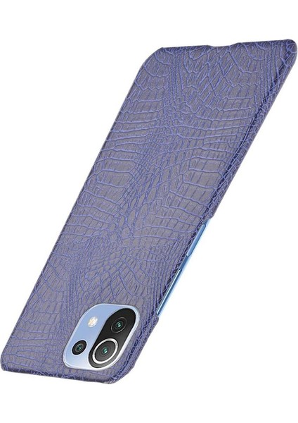 Xiaomi Mi 11 Lite Klasik Timsah Moda Kapak Için Şık Klasik Durumda (Yurt Dışından)