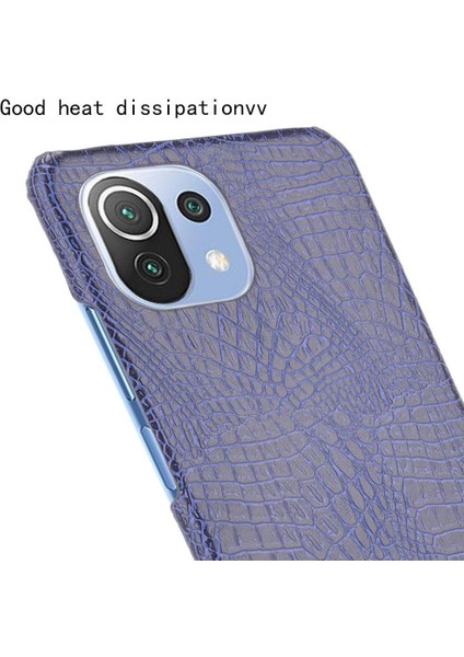 Xiaomi Mi 11 Lite Klasik Timsah Moda Kapak Için Şık Klasik Durumda (Yurt Dışından)