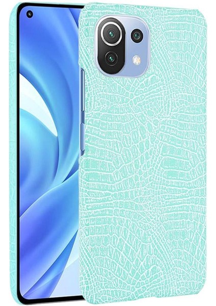Xiaomi Mi 11 Lite Klasik Timsah Moda Kapak Için Şık Klasik Durumda (Yurt Dışından)