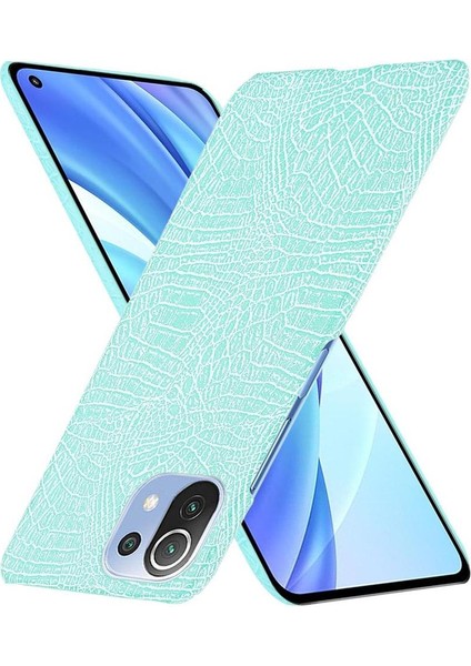 Xiaomi Mi 11 Lite Klasik Timsah Moda Kapak Için Şık Klasik Durumda (Yurt Dışından)