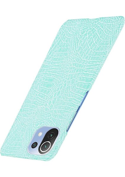 Xiaomi Mi 11 Lite Klasik Timsah Moda Kapak Için Şık Klasik Durumda (Yurt Dışından)