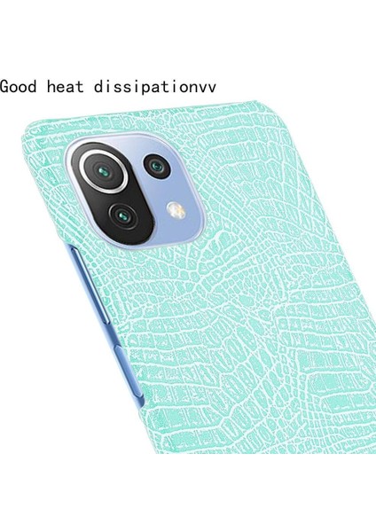 Xiaomi Mi 11 Lite Klasik Timsah Moda Kapak Için Şık Klasik Durumda (Yurt Dışından)