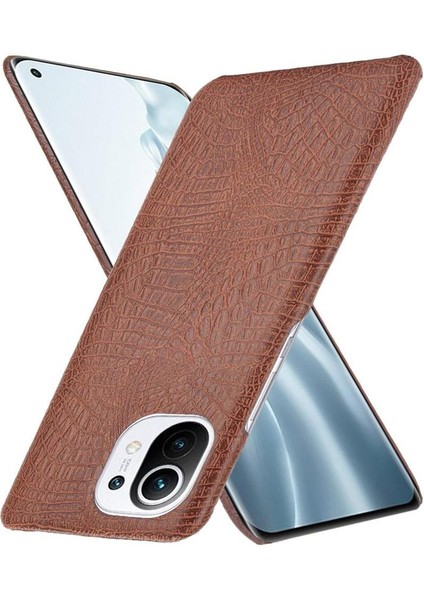 Xiaomi Mi 11 Klasik Timsah Moda Anti Kapak Için Şık Klasik Durumda (Yurt Dışından)