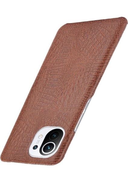 Xiaomi Mi 11 Klasik Timsah Moda Anti Kapak Için Şık Klasik Durumda (Yurt Dışından)