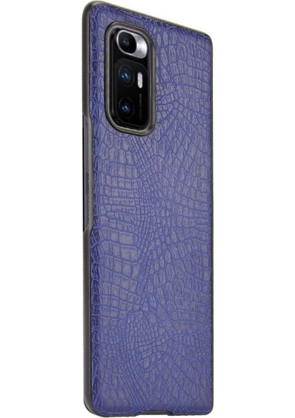 Xiaomi Mi Mix Kat Klasik Timsah Moda Anti Için Şık Klasik Durumda (Yurt Dışından) indirimleri