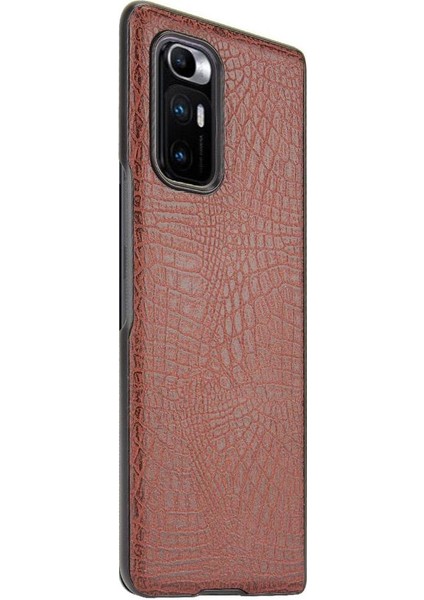 Xiaomi Mi Mix Kat Klasik Timsah Moda Anti Için Şık Klasik Durumda (Yurt Dışından) fırsatları