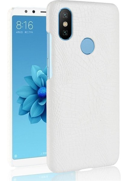 Xiaomi Mi A2 /mi 6x Anti Scratch Koruyucu Kapak Için Şık Klasik Kılıf (Yurt Dışından)