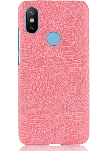 Xiaomi Mi A2 /mi 6x Anti Scratch Koruyucu Kapak Için Şık Klasik Kılıf (Yurt Dışından)