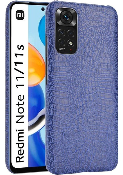 Xiaomi Redmi Not 11 Için Şık Klasik Durumda 4g /11S Anti Scratch Kapak (Yurt Dışından)