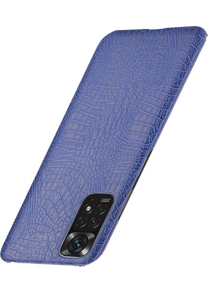 Xiaomi Redmi Not 11 Için Şık Klasik Durumda 4g /11S Anti Scratch Kapak (Yurt Dışından)