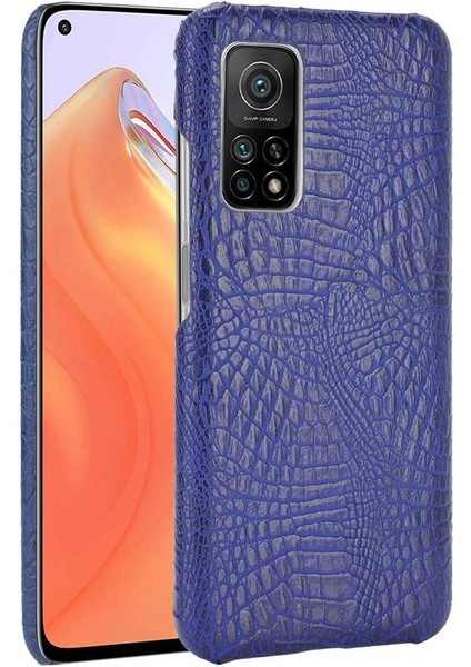 Şık Klasik Durumda Xiaomi Mi 10T Pro 5G/10T 5g Klasik Timsah (Yurt Dışından)