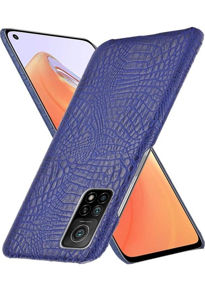 Şık Klasik Durumda Xiaomi Mi 10T Pro 5G/10T 5g Klasik Timsah (Yurt Dışından)