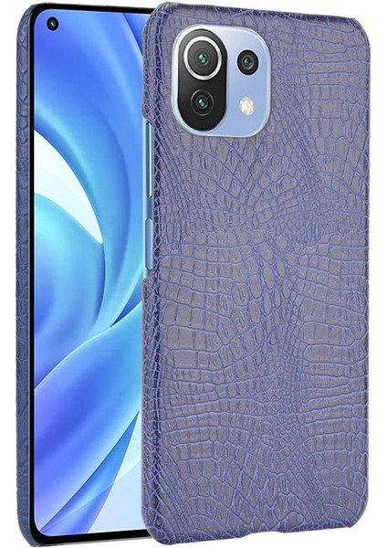 Xiaomi Mi 11 Lite Klasik Timsah Moda Kapak Için Şık Klasik Durumda (Yurt Dışından)