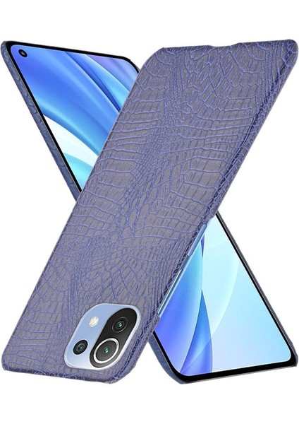 Xiaomi Mi 11 Lite Klasik Timsah Moda Kapak Için Şık Klasik Durumda (Yurt Dışından)