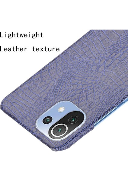 Xiaomi Mi 11 Lite Klasik Timsah Moda Kapak Için Şık Klasik Durumda (Yurt Dışından)