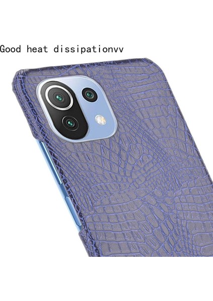 Xiaomi Mi 11 Lite Klasik Timsah Moda Kapak Için Şık Klasik Durumda (Yurt Dışından)
