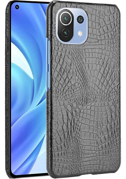 Xiaomi Mi 11 Lite Klasik Timsah Moda Kapak Için Şık Klasik Durumda (Yurt Dışından)