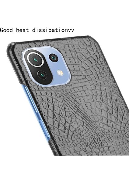 Xiaomi Mi 11 Lite Klasik Timsah Moda Kapak Için Şık Klasik Durumda (Yurt Dışından)