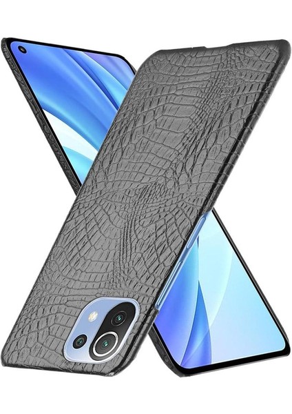 Xiaomi Mi 11 Lite Klasik Timsah Moda Kapak Için Şık Klasik Durumda (Yurt Dışından)