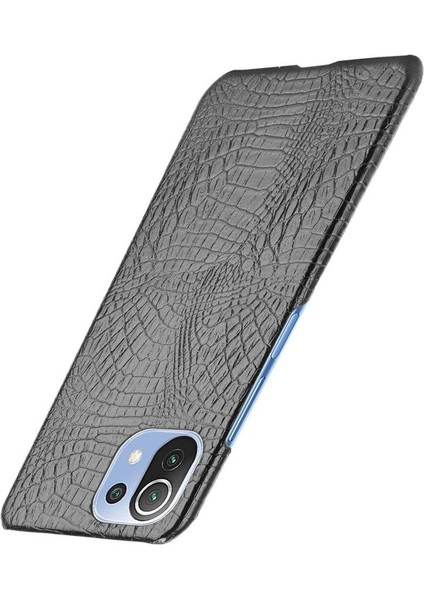Xiaomi Mi 11 Lite Klasik Timsah Moda Kapak Için Şık Klasik Durumda (Yurt Dışından)