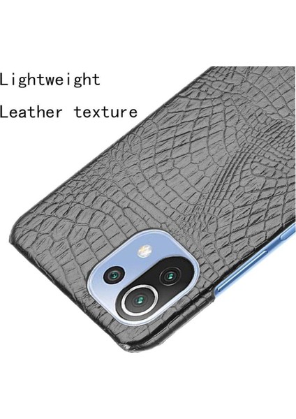 Xiaomi Mi 11 Lite Klasik Timsah Moda Kapak Için Şık Klasik Durumda (Yurt Dışından)