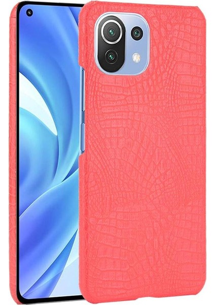 Xiaomi Mi 11 Lite Klasik Timsah Moda Kapak Için Şık Klasik Durumda (Yurt Dışından)