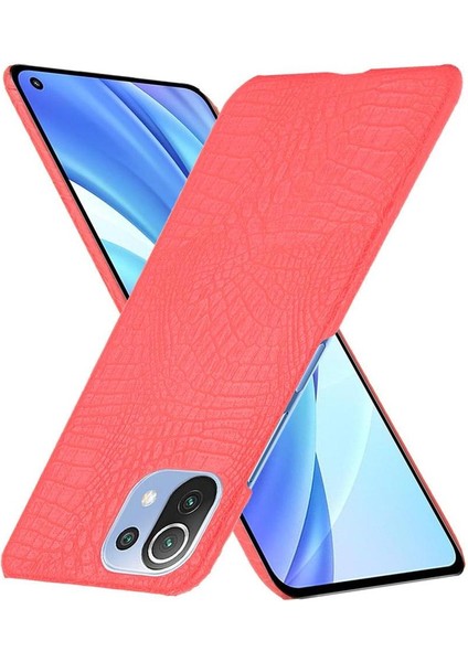 Xiaomi Mi 11 Lite Klasik Timsah Moda Kapak Için Şık Klasik Durumda (Yurt Dışından)