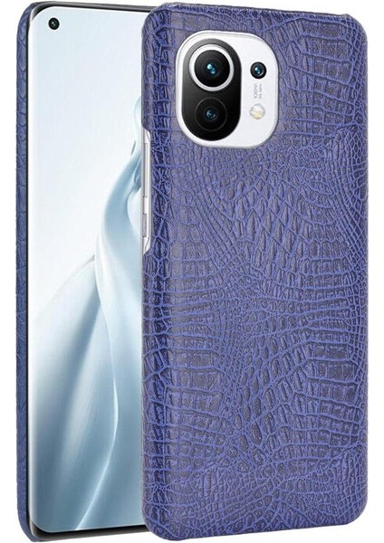 Xiaomi Mi 11 Klasik Timsah Moda Anti Kapak Için Şık Klasik Durumda (Yurt Dışından)