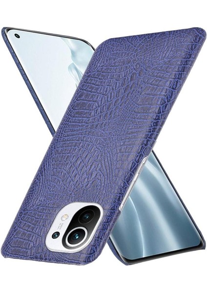 Xiaomi Mi 11 Klasik Timsah Moda Anti Kapak Için Şık Klasik Durumda (Yurt Dışından)