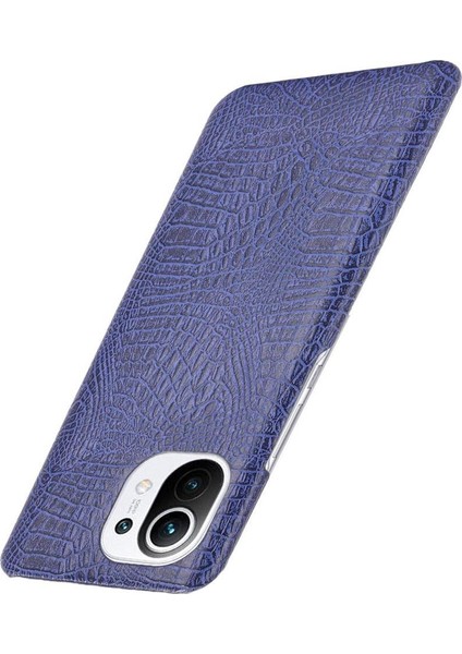 Xiaomi Mi 11 Klasik Timsah Moda Anti Kapak Için Şık Klasik Durumda (Yurt Dışından)
