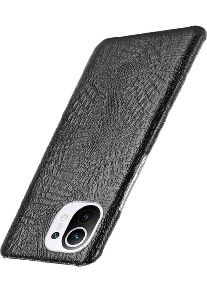 Xiaomi Mi 11 Klasik Timsah Moda Anti Kapak Için Şık Klasik Durumda (Yurt Dışından)