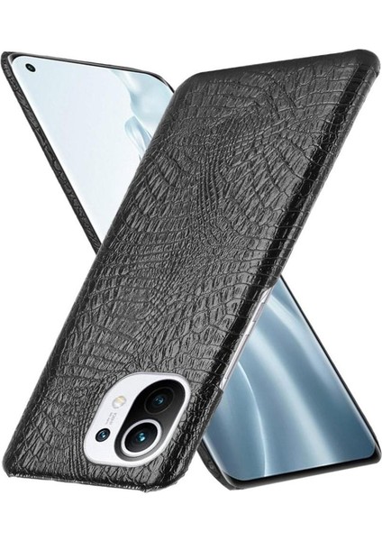 Xiaomi Mi 11 Klasik Timsah Moda Anti Kapak Için Şık Klasik Durumda (Yurt Dışından)