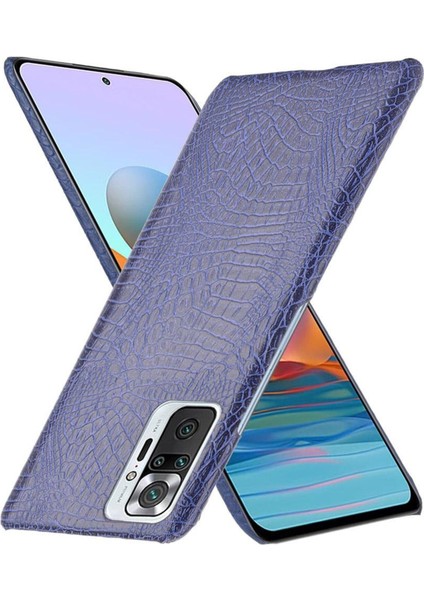 Xiaomi Redmi Not 10 Pro Max Klasik Timsah Için Şık Klasik Durumda (Yurt Dışından)