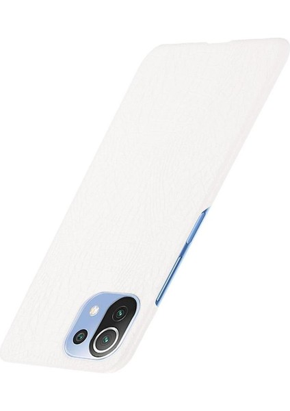 Xiaomi Mi 11 Lite Klasik Timsah Moda Kapak Için Şık Klasik Durumda (Yurt Dışından) fiyatları