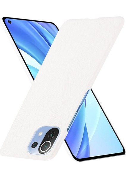 Xiaomi Mi 11 Lite Klasik Timsah Moda Kapak Için Şık Klasik Durumda (Yurt Dışından) fırsatları