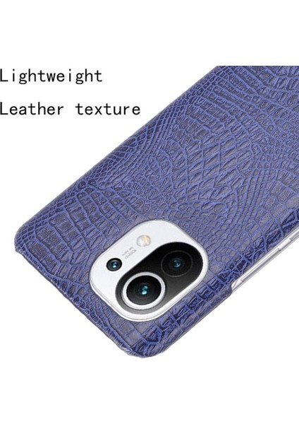 Xiaomi Mi 11 Klasik Timsah Moda Anti Kapak Için Şık Klasik Durumda (Yurt Dışından) modelleri