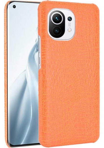 Xiaomi Mi 11 Klasik Timsah Moda Anti Kapak Için Şık Klasik Durumda (Yurt Dışından)