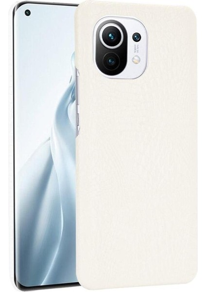 Xiaomi Mi 11 Klasik Timsah Moda Anti Kapak Için Şık Klasik Durumda (Yurt Dışından)