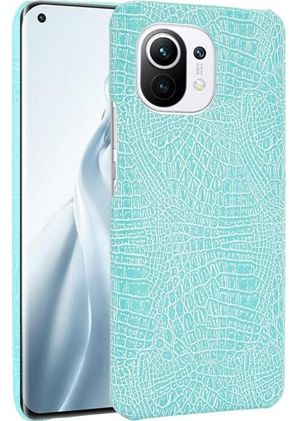 Xiaomi Mi 11 Klasik Timsah Moda Anti Kapak Için Şık Klasik Durumda (Yurt Dışından)