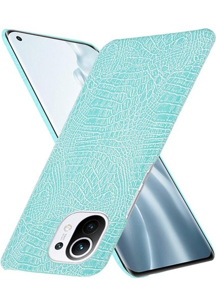 Xiaomi Mi 11 Klasik Timsah Moda Anti Kapak Için Şık Klasik Durumda (Yurt Dışından) indirimleri