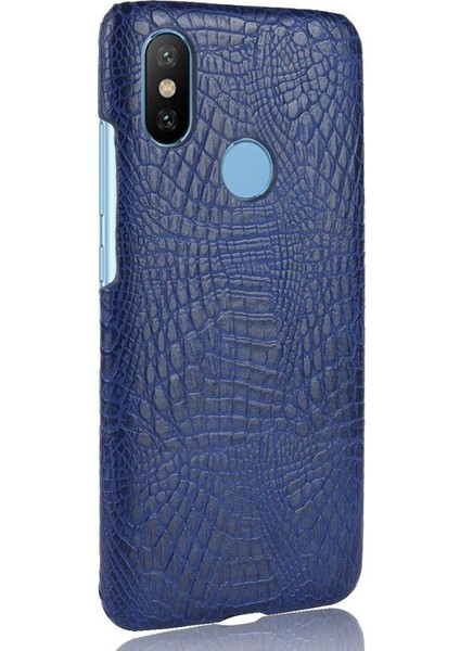 Şık Klasik Durumda Xiaomi Mi A2 Lite /redmi 6 Pro Anti Scratch Kapak (Yurt Dışından)