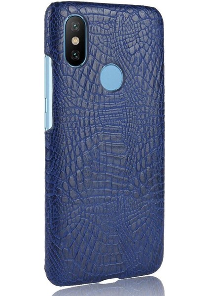 Xiaomi A2 Telefon Kılıfı (Yurt Dışından)