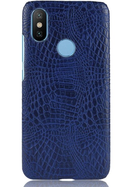 Xiaomi A2 Telefon Kılıfı (Yurt Dışından)