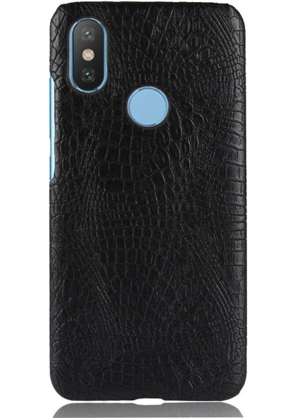 Xiaomi A2 Telefon Kılıfı (Yurt Dışından)