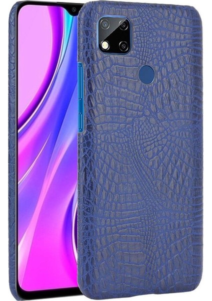 Bdt Shop Xiaomi Redmi 9C Telefon Kılıfı (Yurt Dışından)