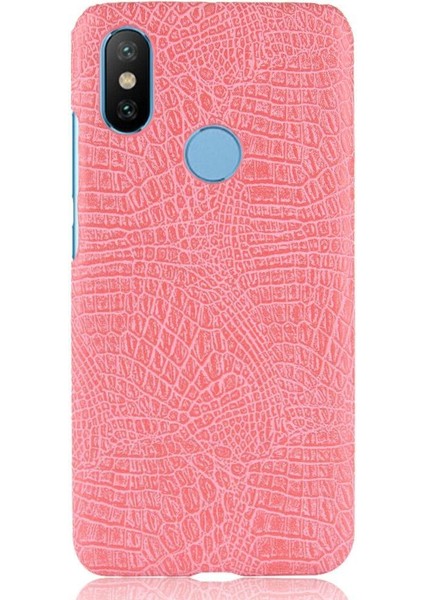 Xiaomi A2 Lite Telefon Kılıfı (Yurt Dışından)