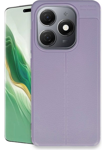 Tecno Spark 20 Kılıf Auto Focus Deri Desen Silikon Arka Kapak